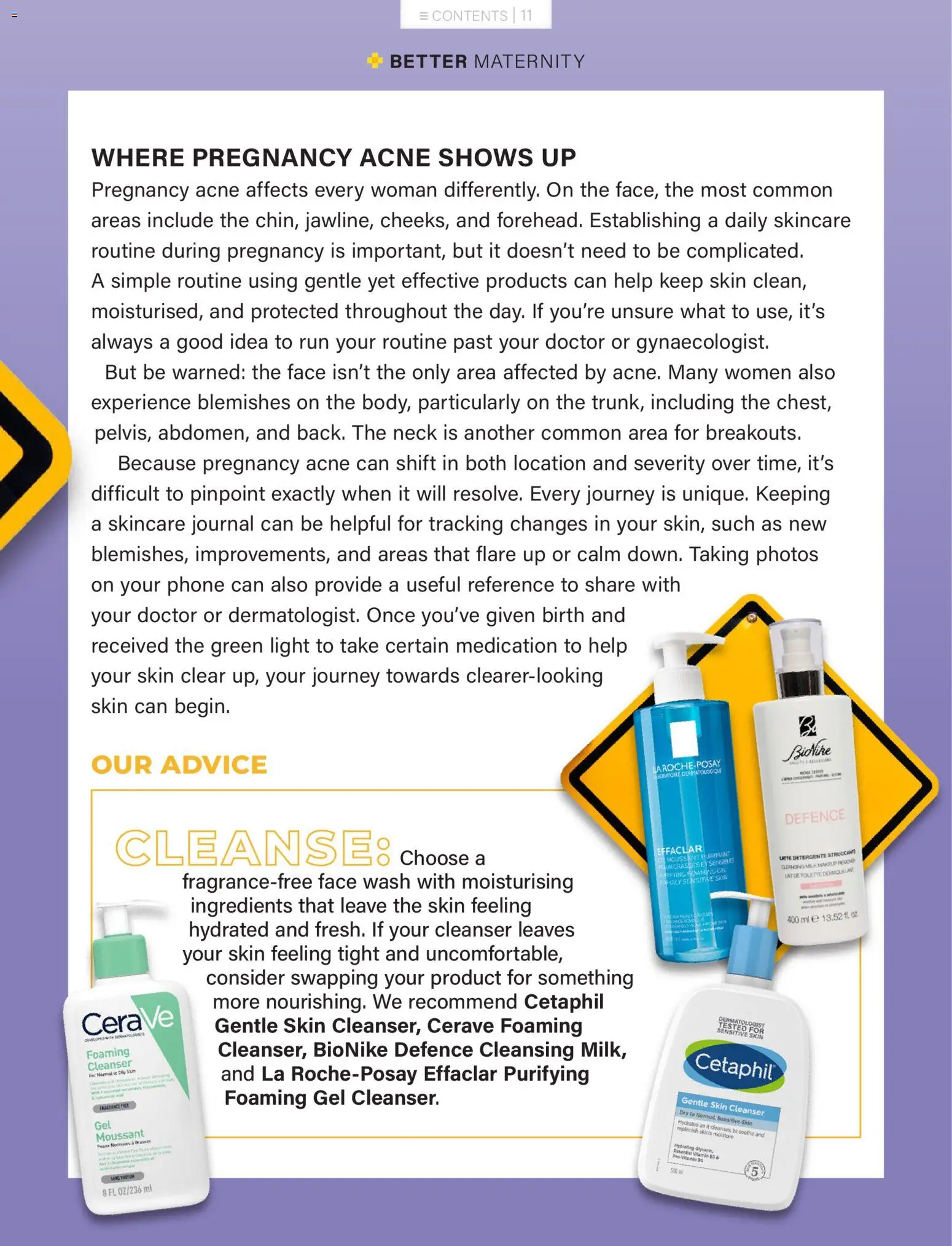 New Baby City catalogue – valid from 01.03.2026 | Page: 11 | Products: Phone, Light